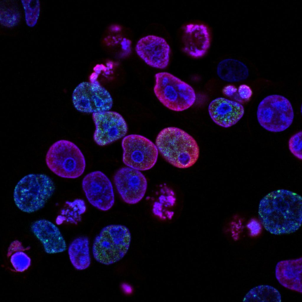 purple cells under a microscope
